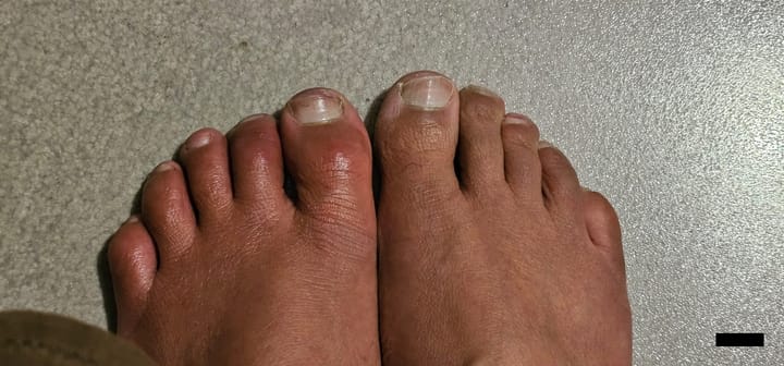 55M Circulation Issues in Feet, Farnborough PaJR