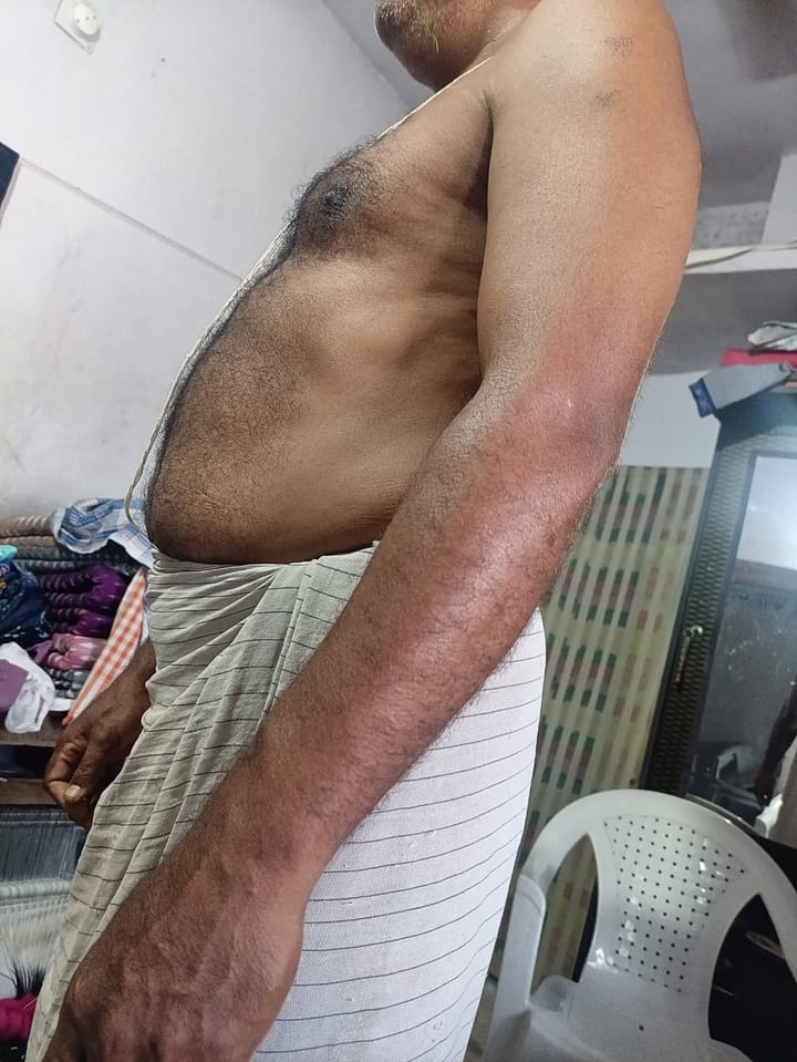 52M Bp Telangana PaJR
