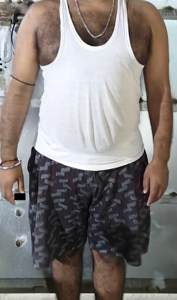 28M Epilepsy 20 years Bihar PaJR