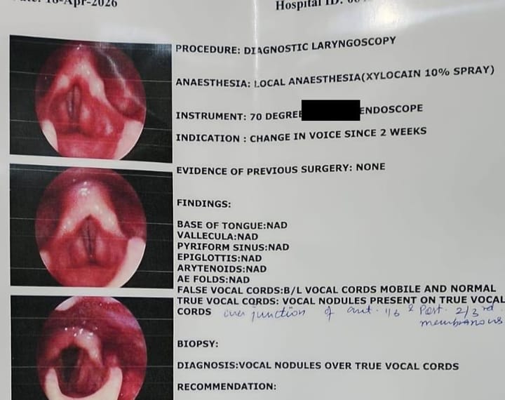 53M Vocal Nodules post dryness of throat 3 weeks MP PaJR