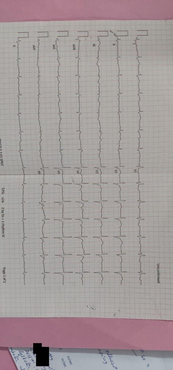 66M CVA infarcts bicytopenia Telangana PaJR