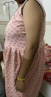 24F Diabetes metabolic gall stones 1 year chronic headache, anemia 7 yrs WB PaJR